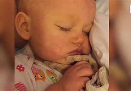 Image result for Sepsis Baby