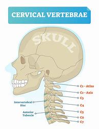 Image result for Cervical Spine C4 C5