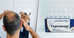 Image result for Topamax Hair Loss