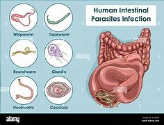 Image result for Parasitos Intestinales