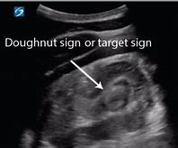Image result for Us Donut or Target. Sign