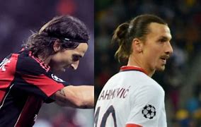Image result for Zlatan Ibrahimovic Nose Before After