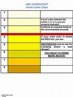 Image result for Urine Color Meaning Chart