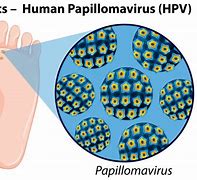 Image result for Genital Human Papillomavirus Oral