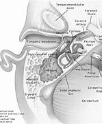 Image result for Internal Auditory Meatus