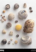 Image result for GallStone Size