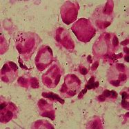Image result for Gram-negative Chlamydia