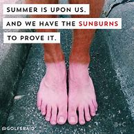 Image result for Bad Sunburn Funny