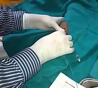 Image result for Chemotherapy PICC Line