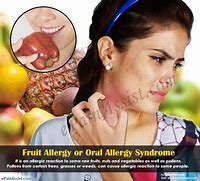 Image result for Mouth Allergy Apple