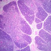 Image result for Thymus Microscope Slide