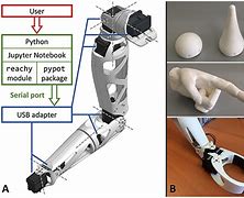 Image result for People with Robotic Limbs