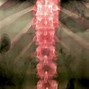 Image result for Pediatric Lumbar Spine
