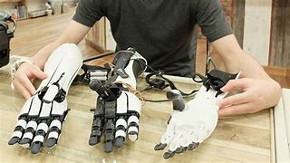 Image result for Prosthetic Robotic Arm 3D Print