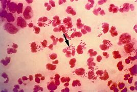 Image result for N. Gonorrhea Gram Stain