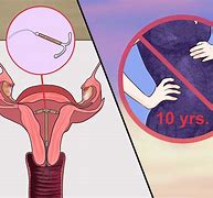 Image result for Emergency Contraception