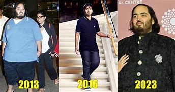 Image result for Anant Ambani Current Pic