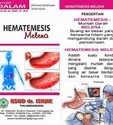 Image result for hematemesis
