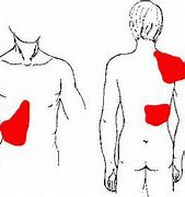 Image result for Gallbladder Attack Pain Location