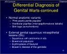 Image result for In Early Stages Genital Human Papillomavirus