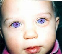 Image result for Top 10 Rarest Eye Colors