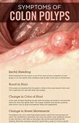 Image result for Colon Tumor Size Chart
