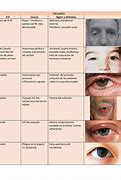 Image result for asinergia