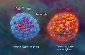 Image result for Basal Cell vs Melanoma