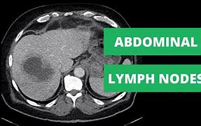 Image result for Abdomen Anatomy Lymph Nodes