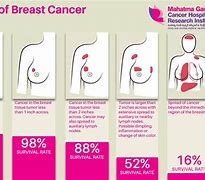 Image result for Stages of Cancer Tumor Size