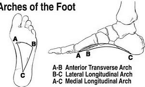 Image result for Foot Arch Chart