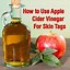 Image result for Apple Cider Vinegar Skin