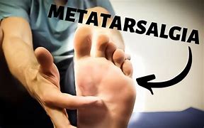 Image result for Ball Foot Pain Treatment