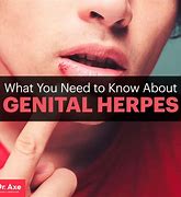 Image result for Genital Pimples On Women