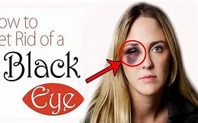 Image result for Things with Black Eye and Fuzzy