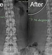 Image result for Chiropractic X-rays