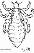 Image result for What Does Head Lice Look Like