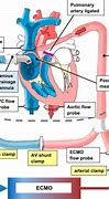 Image result for Blood Flow in Bypass Machine