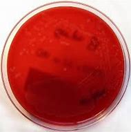 Image result for columbia_agar