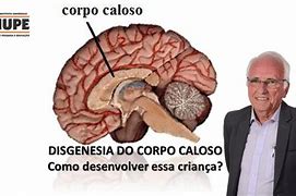 Image result for caloso