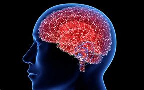 Image result for Types of Brain Disease