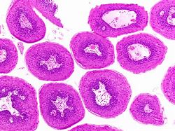 Image result for Squamous Cell Papilloma Histopathology