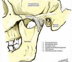 Image result for Jaw Bone Pain