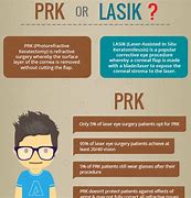 Image result for PRK Marks vs Lasik