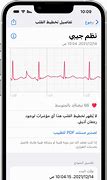 Image result for Af ECG Apple Watch