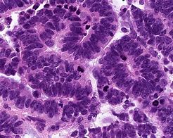 Image result for Choroid Plexus Histology