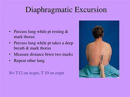 Image result for Diaphragm Excursion