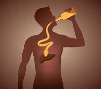 Image result for Signs Alcoholic Liver Disease