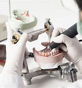 Image result for New Dentistry Techniques
