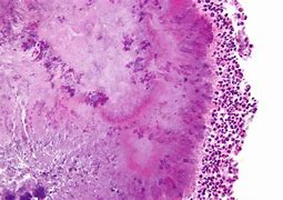 Image result for actinomides
